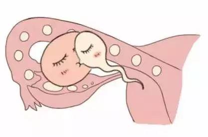 人工孕妈代怀助孕咨询怎么选